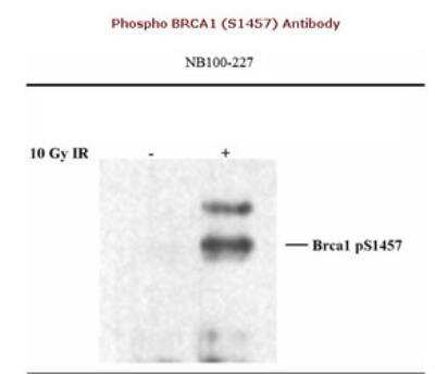 Western Blot: BRCA1 [p Ser1457] Antibody [NB100-227] - Whole Cell Lysate (25ug/lane) from HELA cells treated with 10 Gy IR or untreated